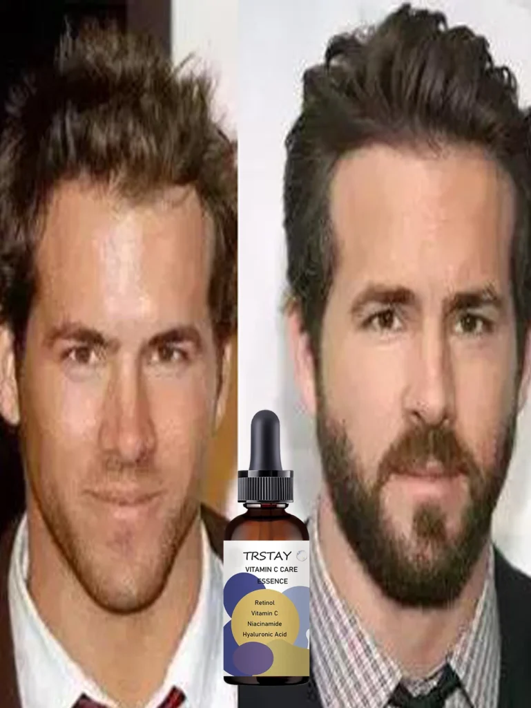 Top Beard Oils for Softer, Healthier Facial Hair and Enhanced Style Top Beard Oils for Softer, Healthier Facial Hair and Enhanced Style