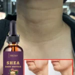 Effective Neck Lift Review 2024 Benefits for Smoother, Youthful Skin