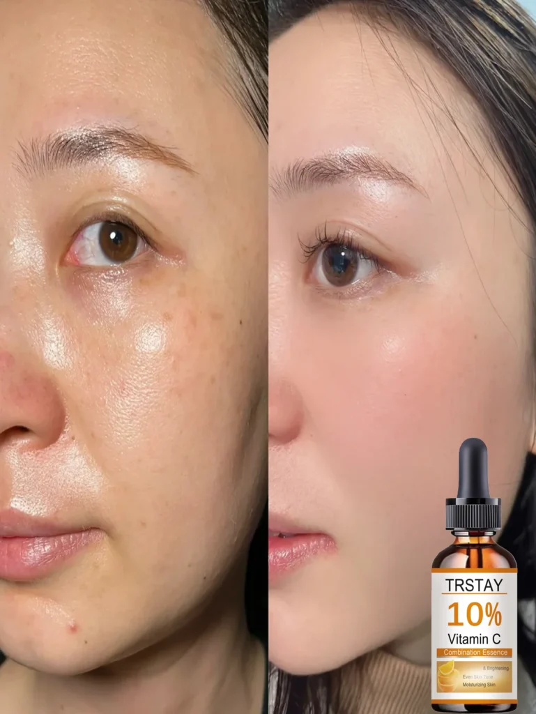 Discover the Best Alcohol-Free Facial Oil for Deep Hydration and Radiant Skin