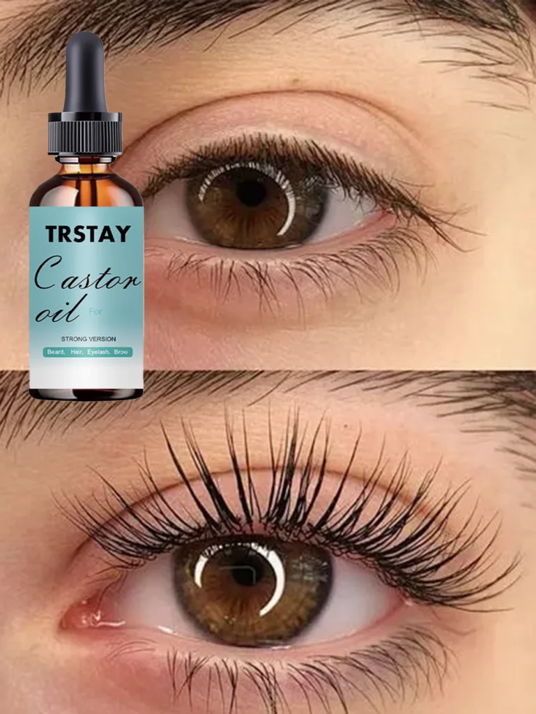 Effective Eye Oil Review for Reducing Dark Circles and Wrinkles Naturally Effective Eye Oil Review for Reducing Dark Circles and Wrinkles Naturally